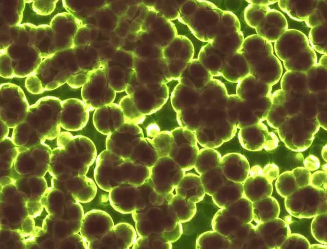 bacteria treatments image